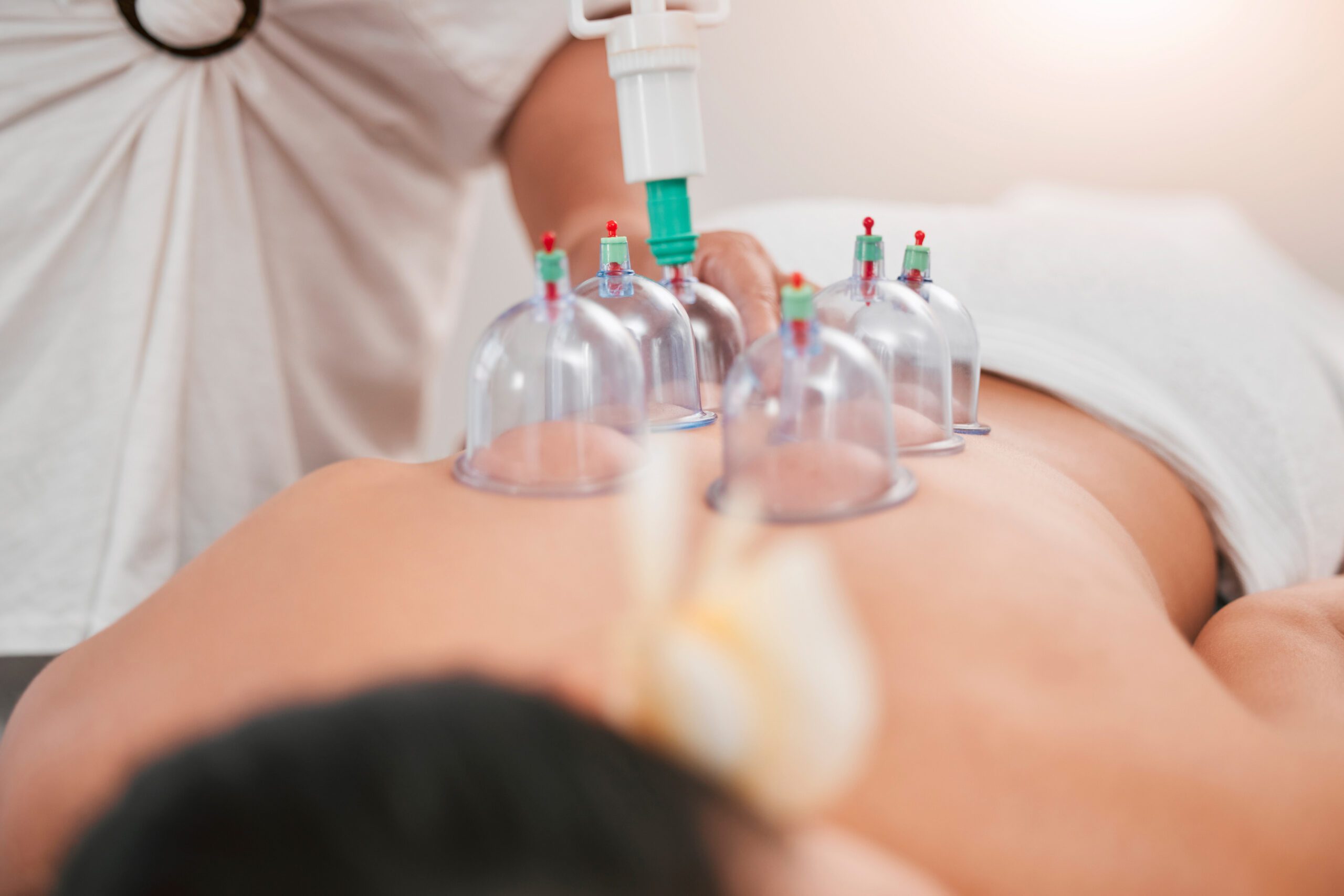 zoom-physiotherapy-woman-with-cupping-therapy-back-pain-physical-therapy-relax-wellness-massage-meditation-helpmedicine-medical-luxury-health-tech-zen-spa-support 1 - Future Center